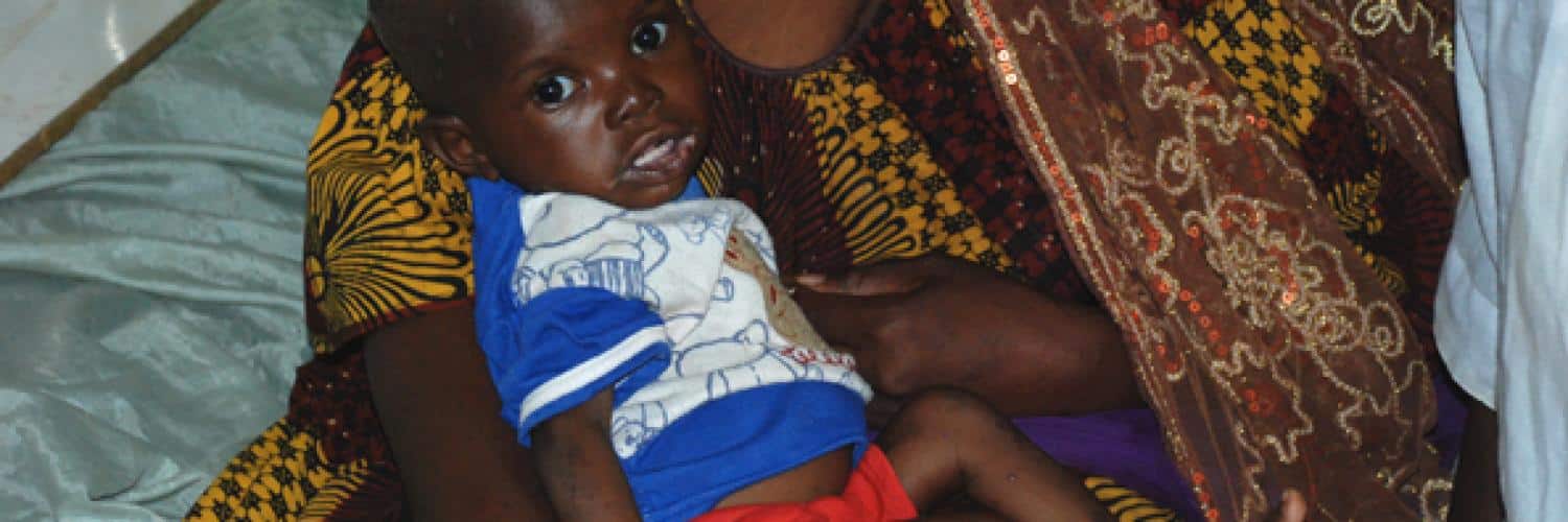 Malnutrition in Mali: causes, impacts and solutions for public health